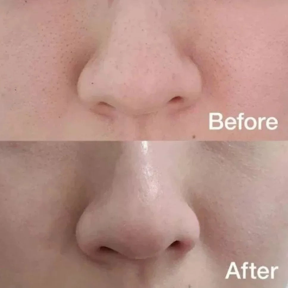 韩国Medicube紧致毛孔爽肤棉片深层保湿去角质黑头粉刺70片正品