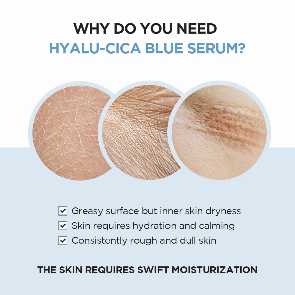 現貨|SKIN1004 Madagascar Centella Hyalu-Cica Blue Serum 積雪草玻尿酸保濕精華 50ml