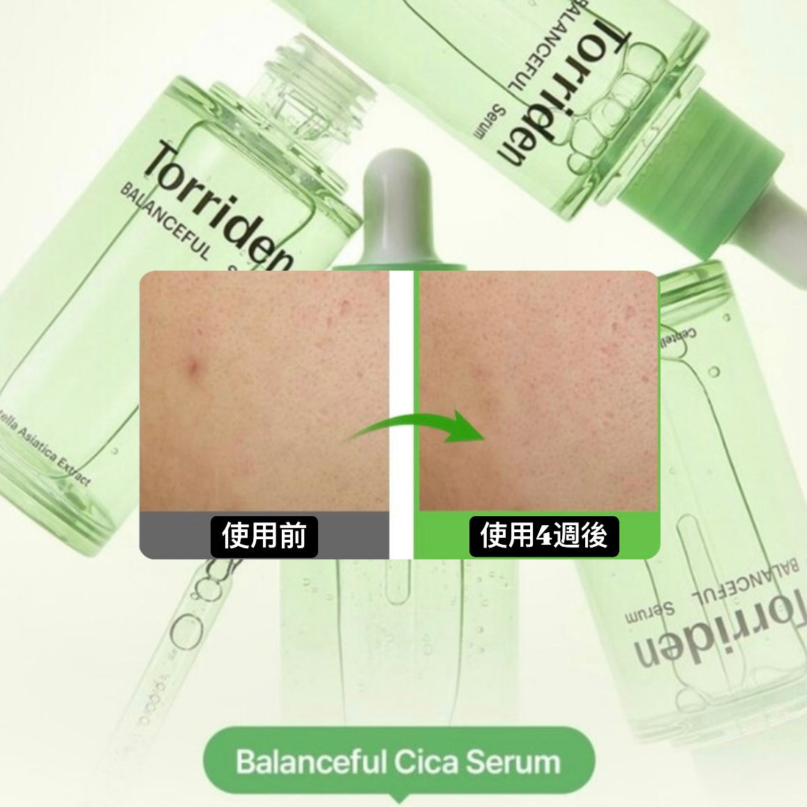 In stock|Torriden 💚 Balanceful Cica Serum Centella Asiatica Moisturizing Calming Essence – 50ml