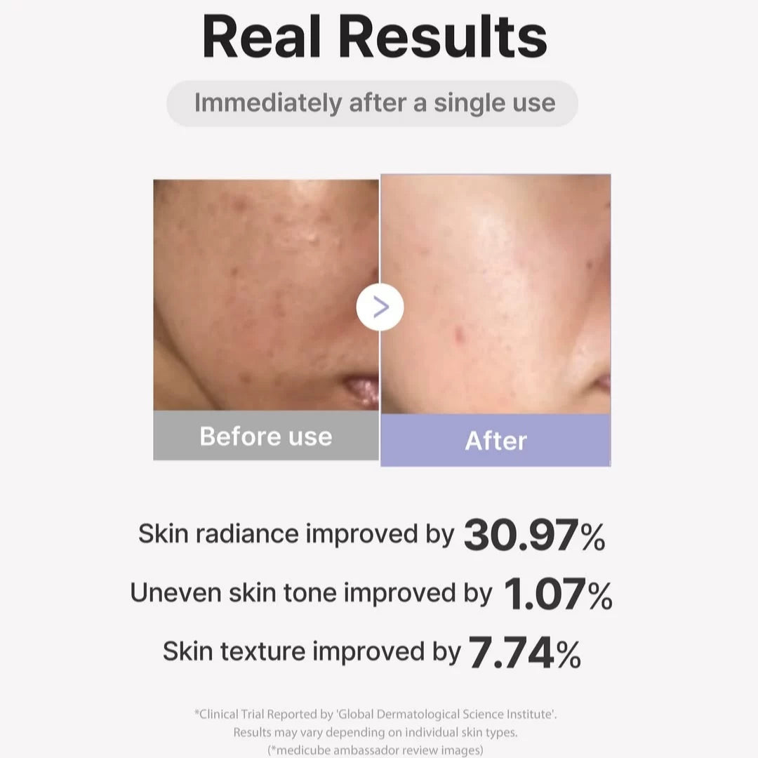 韩国Medicube Pro mini美蒂秋芙多效美容仪淡斑美白改善毛孔正品