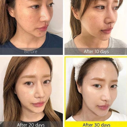 韩国somebymi莎柏蜜烟酰胺柚子亮白精华保湿淡斑抗氧化舒缓正品