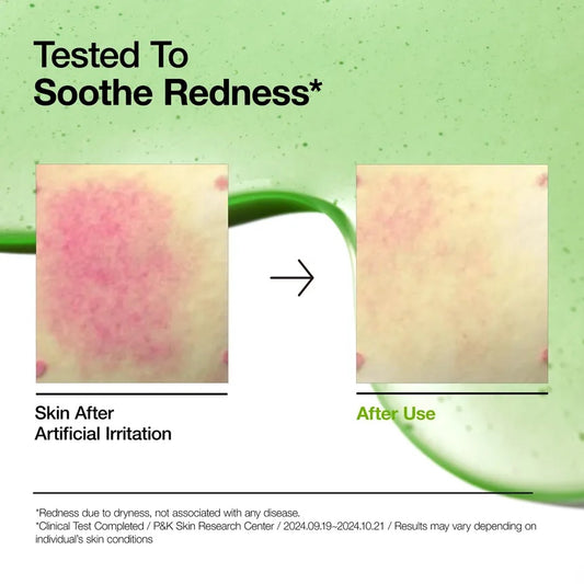 In stock｜ANUA Azelaic Acid 10 Hyaluron Redness Soothing Serum 10% salicylic acid and hyaluronic acid soothing and anti-redness essence 30ml 