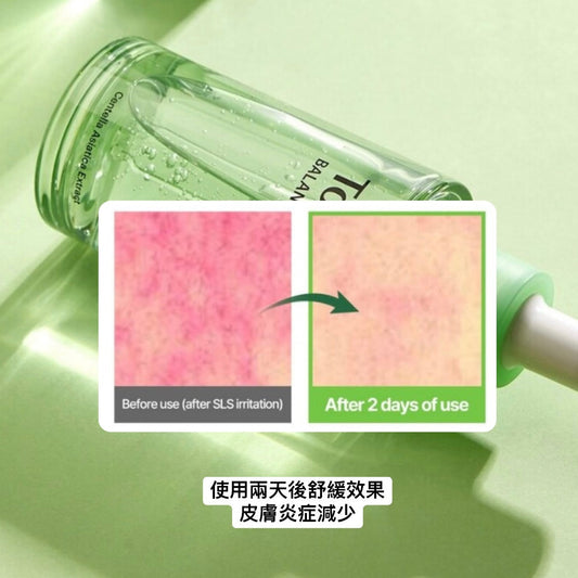 In stock｜Torriden 💚 Balanceful Cica Serum Centella Asiatica Moisturizing Calming Essence – 50ml