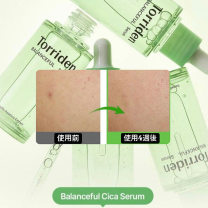 现货｜Torriden 💚 Balanceful Cica Serum 積雪草保濕鎮靜精華 – 50ml